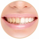 黄牙