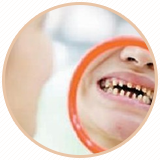 牙齿稀疏
