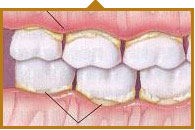术前免费3D牙周管理