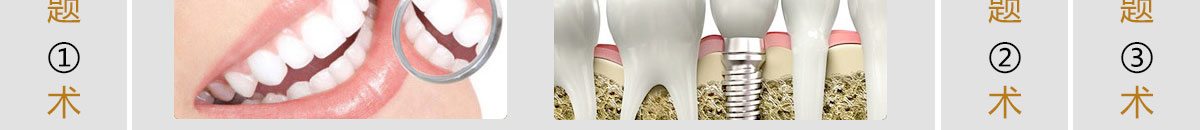 Nobel即刻种植牙术前检查