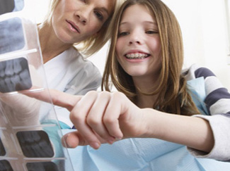 自锁托槽矫正,北京京通医院口腔中心