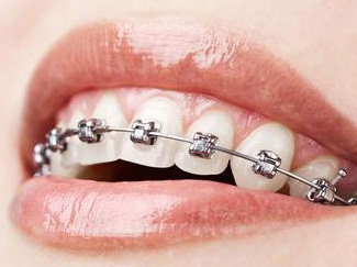 牙齿矫正,北京京通医院口腔中心