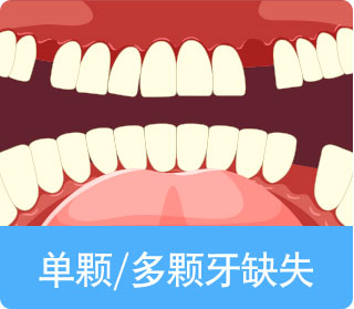 通州牙齿种植,通州牙齿修复,通州儿童涂氟,通州窝沟封闭,北京京通医院