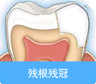 通州牙齿种植,通州牙齿修复,通州儿童涂氟,通州窝沟封闭,北京京通医院