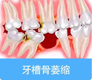 通州牙齿种植,通州牙齿修复,通州儿童涂氟,通州窝沟封闭,北京京通医院